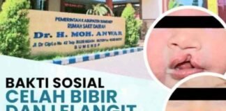 Gelar Baksos Cleft Lip and Palate,Dirut RSUDMA Sumenep; Senyum Pasien adalah Kepuasan Bagi Kami