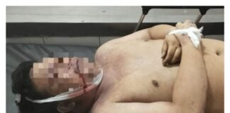 Viral…!!! Launching Diskotik BN Binjai, Salah Satu Pengunjung Tewas Diduga Over Dosis