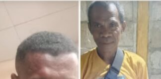 Tindak Pidana Penganiayaan Yosef Fallo Terhadap Yermias Ati Diduga Ada Upaya Pemalsuan Keterangan