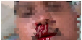 Persoalan Ditagih Biaya Sewa IPhone Berujung Penganiayaan, Terduga Pelaku Dilapor ke Polres Torut