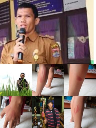 DIDUGA KARENA TAK HAFAL PERKALIAN, OKNUM GURU PPPK DI SD NEGERI 8 TEGA ANIAYA MURID HINGGA LEBAM DIDUGA KARENA TAK HAFAL PERKALIAN, OKNUM GURU PPPK DI SD NEGERI 8 TEGA ANIAYA MURID HINGGA LEBAM