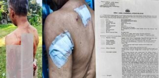 *Wilson Lalengke Kecam Aksi Main Hakim Sendiri, Desak Polisi Usut Tuntas Terduga Pelaku ‘Imron’*